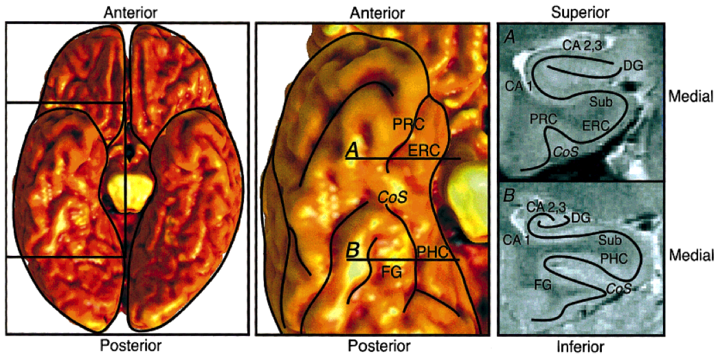 Unfolding-Anat.png