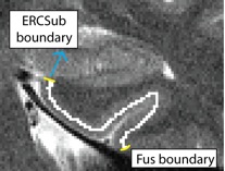 Unfolding-ERCPRCPHC.jpg