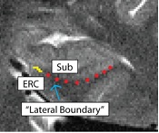 Unfolding-ERCSub.jpg