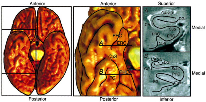 File:Unfolding-Anat.png